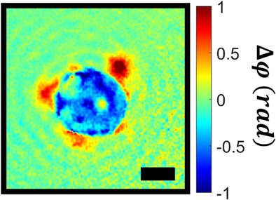 Quantitative phase microscopy monitors subcellular dynamics in single cells exposed to nanosecond pulsed electric fields