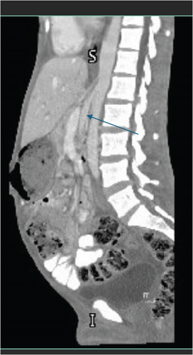 Details are in the caption following the image Details are in the caption following the image