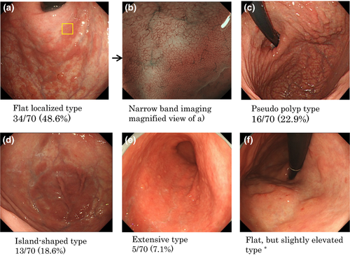 Details are in the caption following the image Details are in the caption following the image