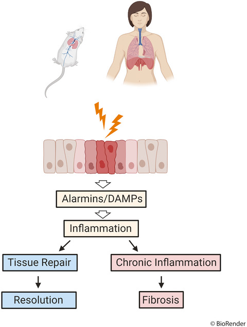 The contribution of animal models to understanding the role of the immune system in human idiopathic pulmonary fibrosis Issue 7, 2020
