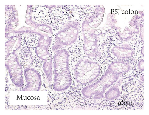 Details are in the caption following the image
