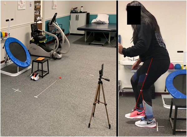 Landing biomechanics deficits in anterior cruciate ligament reconstruction patients can be assessed in a non-laboratory setting