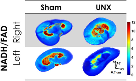 The early effects of uninephrectomy on rat kidney metabolic state using optical imaging