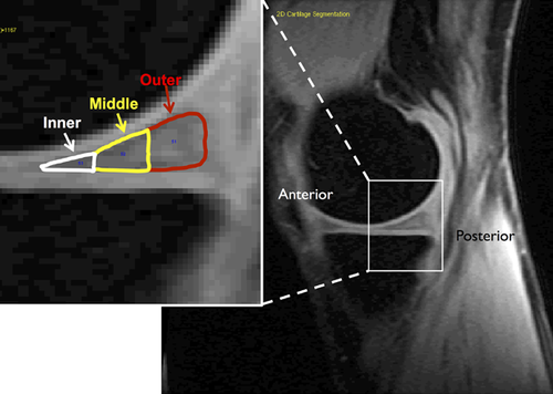 Details are in the caption following the image