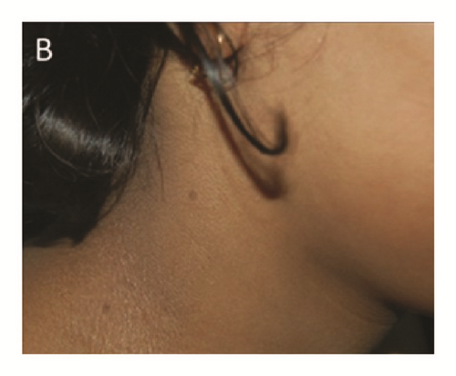 Details are in the caption following the image