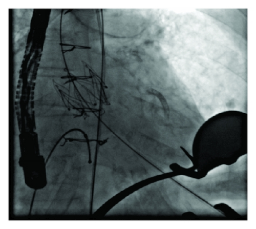 Details are in the caption following the image