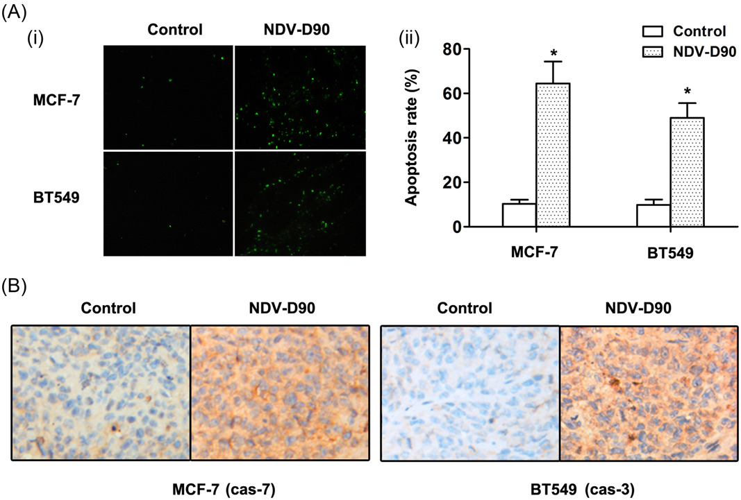 NDV-D90 inhibits 17β-estradiol-mediated resistance to apoptosis by differentially modulating classic and nonclassic estrogen receptors in breast cancer cells