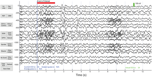 Details are in the caption following the image Details are in the caption following the image