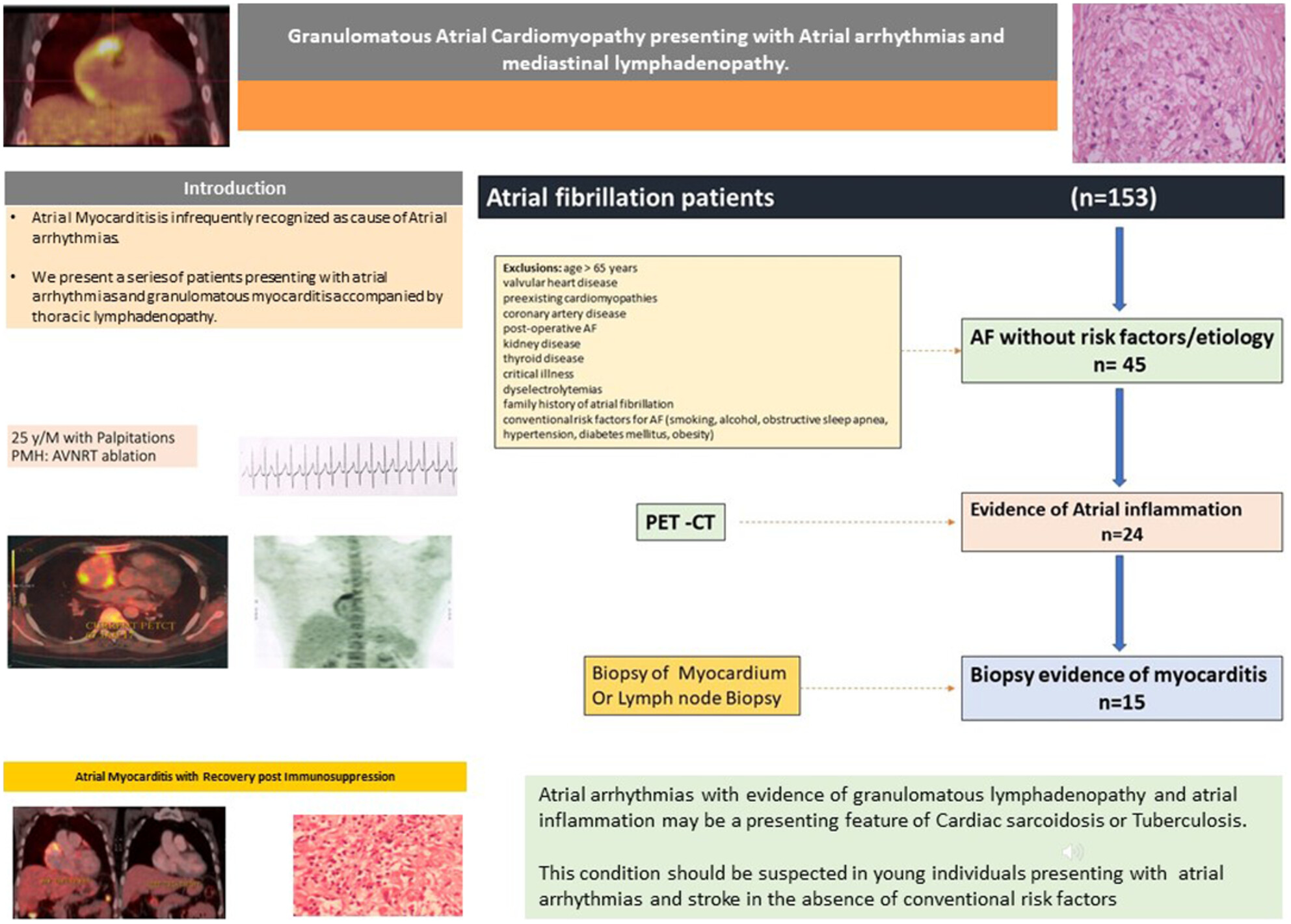 Atrial arrhythmias with mediastinal lymphadenopathy presentation of isolated atrial myocarditis