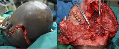 Details are in the caption following the image Details are in the caption following the image