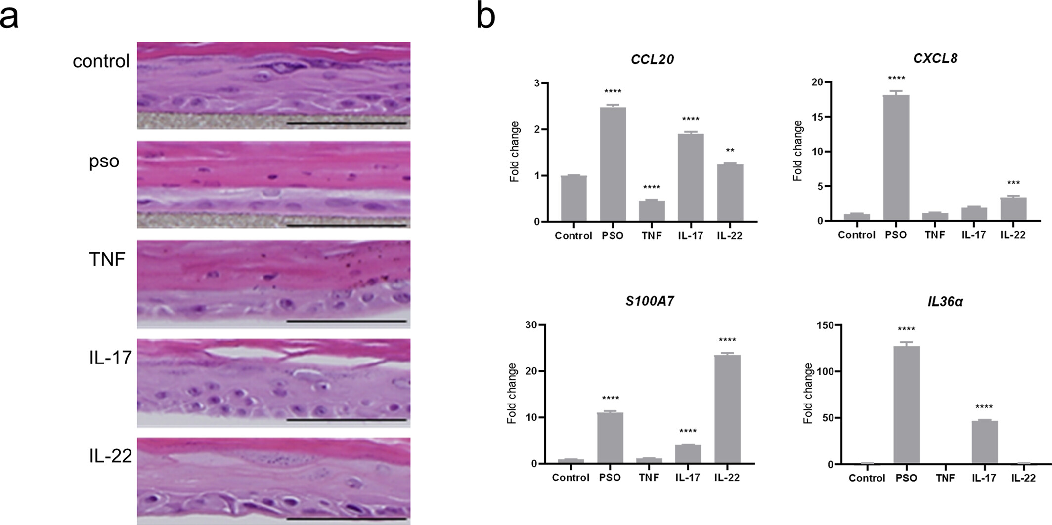 Effect of tumour necrotic factor-α, interleukin-17 and interleukin-22 on the expression of filaggerin-2 and hornerin: Analysis of a three-dimensional psoriatic skin model