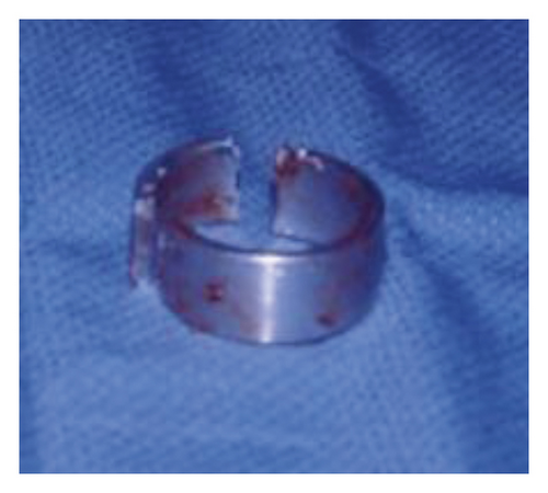 Details are in the caption following the image Details are in the caption following the image