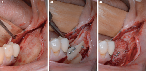 Details are in the caption following the image Details are in the caption following the image