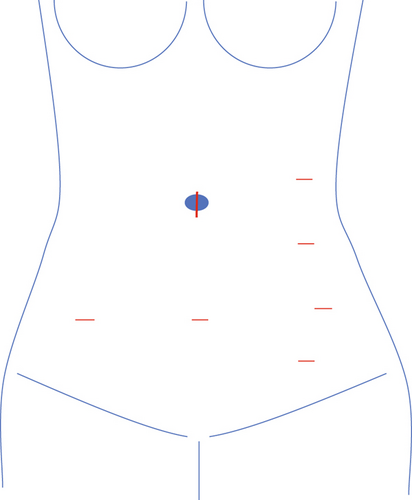 Details are in the caption following the image Details are in the caption following the image