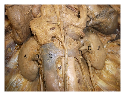 Details are in the caption following the image
