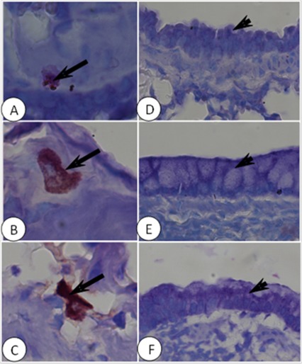 Light-Emitting Diode treatment ameliorates allergic lung inflammation in experimental model of asthma induced by ovalbumin