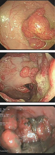 Details are in the caption following the image Details are in the caption following the image