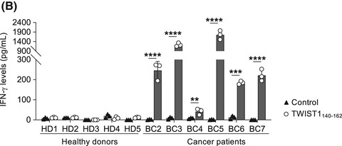 A tumor metastasis-associated molecule TWIST1 is a favorable target for cancer immunotherapy due to its immunogenicity