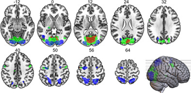 Neural mechanisms of background and velocity effects in smooth pursuit eye movements