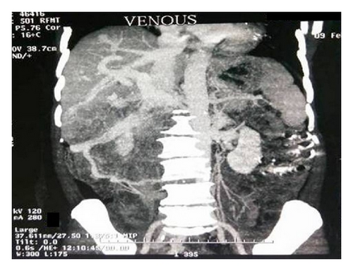 Details are in the caption following the image