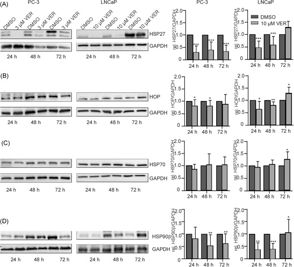 The heat shock protein 70 inhibitor VER155008 suppresses the expression of HSP27, HOP and HSP90β and the androgen receptor, induces apoptosis, and attenuates prostate cancer cell growth