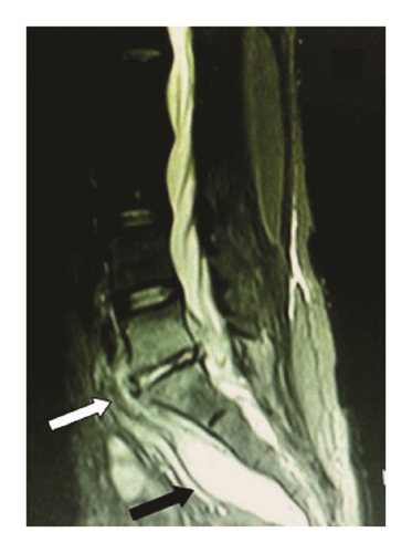 Details are in the caption following the image
