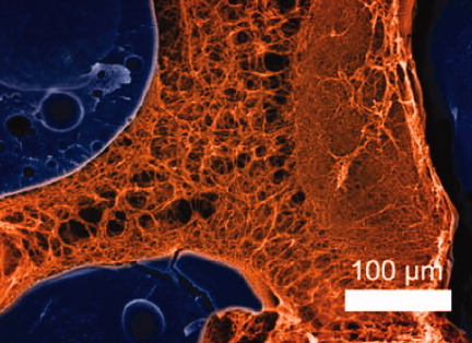 Biomedical applications of biodegradable polymers Issue 12, 2011