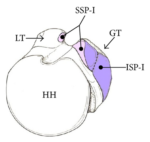 Details are in the caption following the image