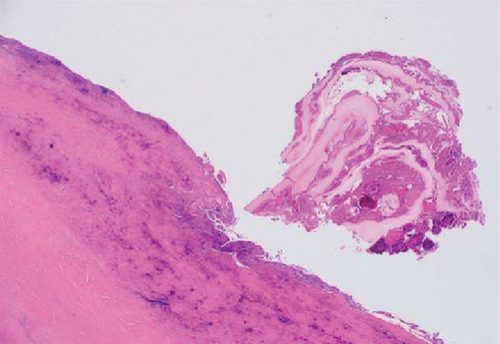 Details are in the caption following the image