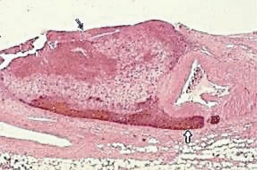Details are in the caption following the image