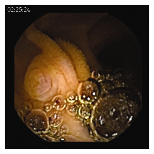 Details are in the caption following the image Details are in the caption following the image