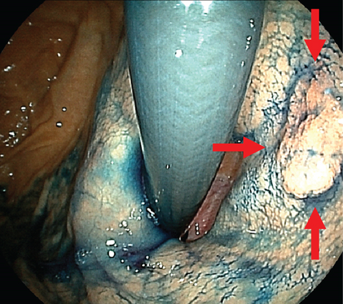 Details are in the caption following the image Details are in the caption following the image