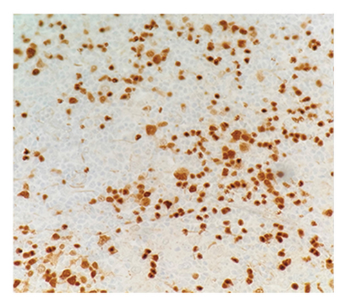 Details are in the caption following the image