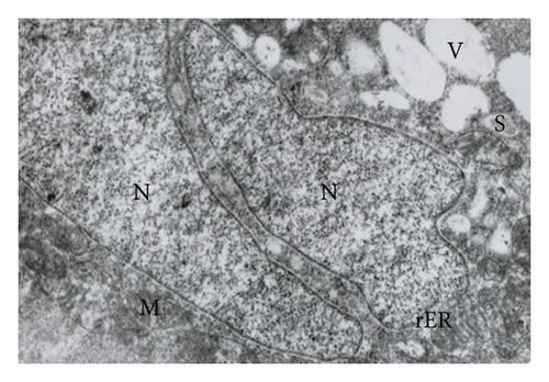 Details are in the caption following the image