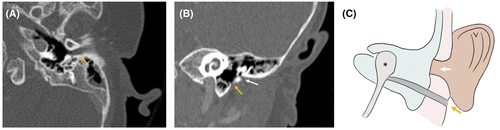 Details are in the caption following the image