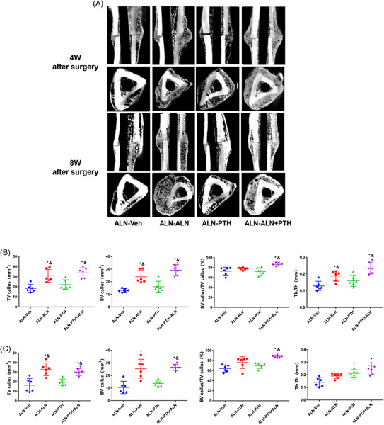 Once-weekly parathyroid hormone combined with ongoing long-term alendronate treatment promotes osteoporotic fracture healing in ovariectomized rats