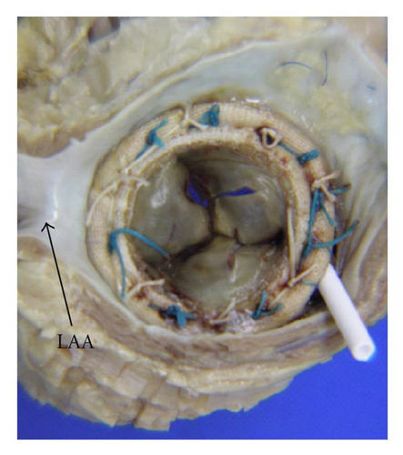 Details are in the caption following the image