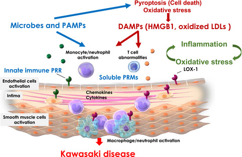 The up-to-date pathophysiology of Kawasaki disease