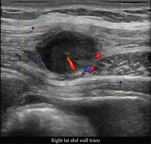 Details are in the caption following the image Details are in the caption following the image