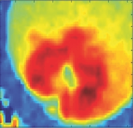 A 3D In Vitro Cancer Model as a Platform for Nanoparticle Uptake and Imaging Investigations