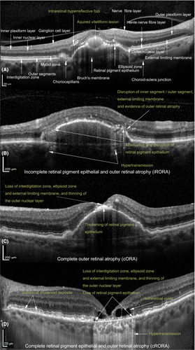 Details are in the caption following the image