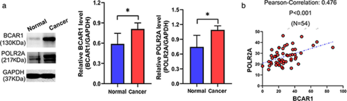 BCAR1 promotes proliferation and cell growth in lung adenocarcinoma via upregulation of POLR2A