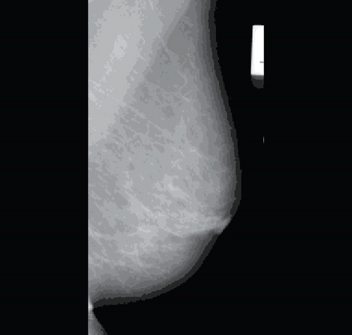 Details are in the caption following the image
