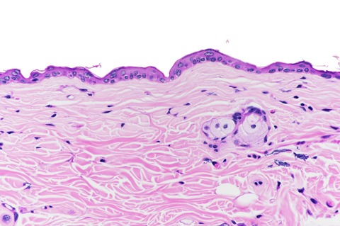 Photo-co-carcinogenesis of Topically Applied Retinyl Palmitate in SKH-1 Hairless Mice