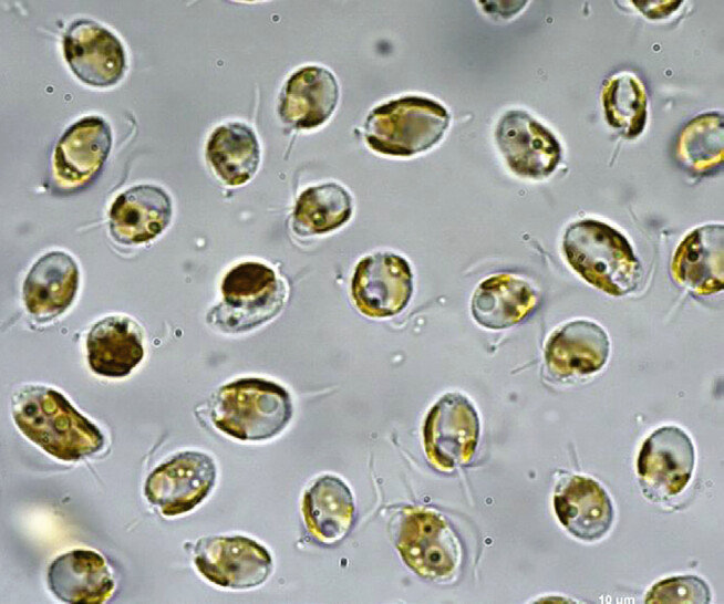 Postulierte Synthese von Prymnesin1 Wie Goldalgen ihre Toxine produzieren