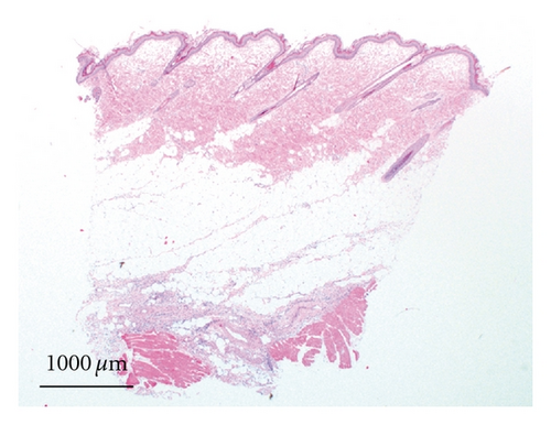 Details are in the caption following the image
