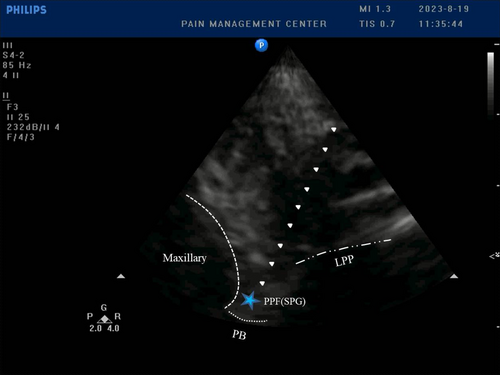 Details are in the caption following the image Details are in the caption following the image