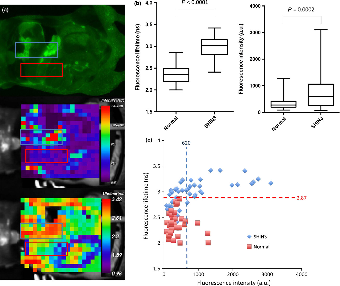 Fluorescence-lifetime molecular imaging can detect invisible peritoneal ovarian tumors in bloody ascites