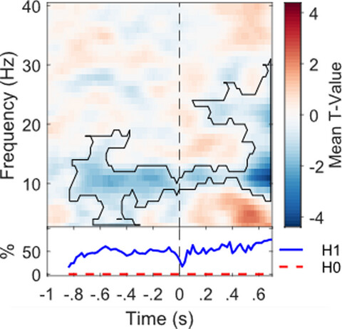 Low pre-stimulus EEG alpha power amplifies visual awareness but not visual sensitivity
