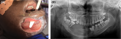 Details are in the caption following the image Details are in the caption following the image